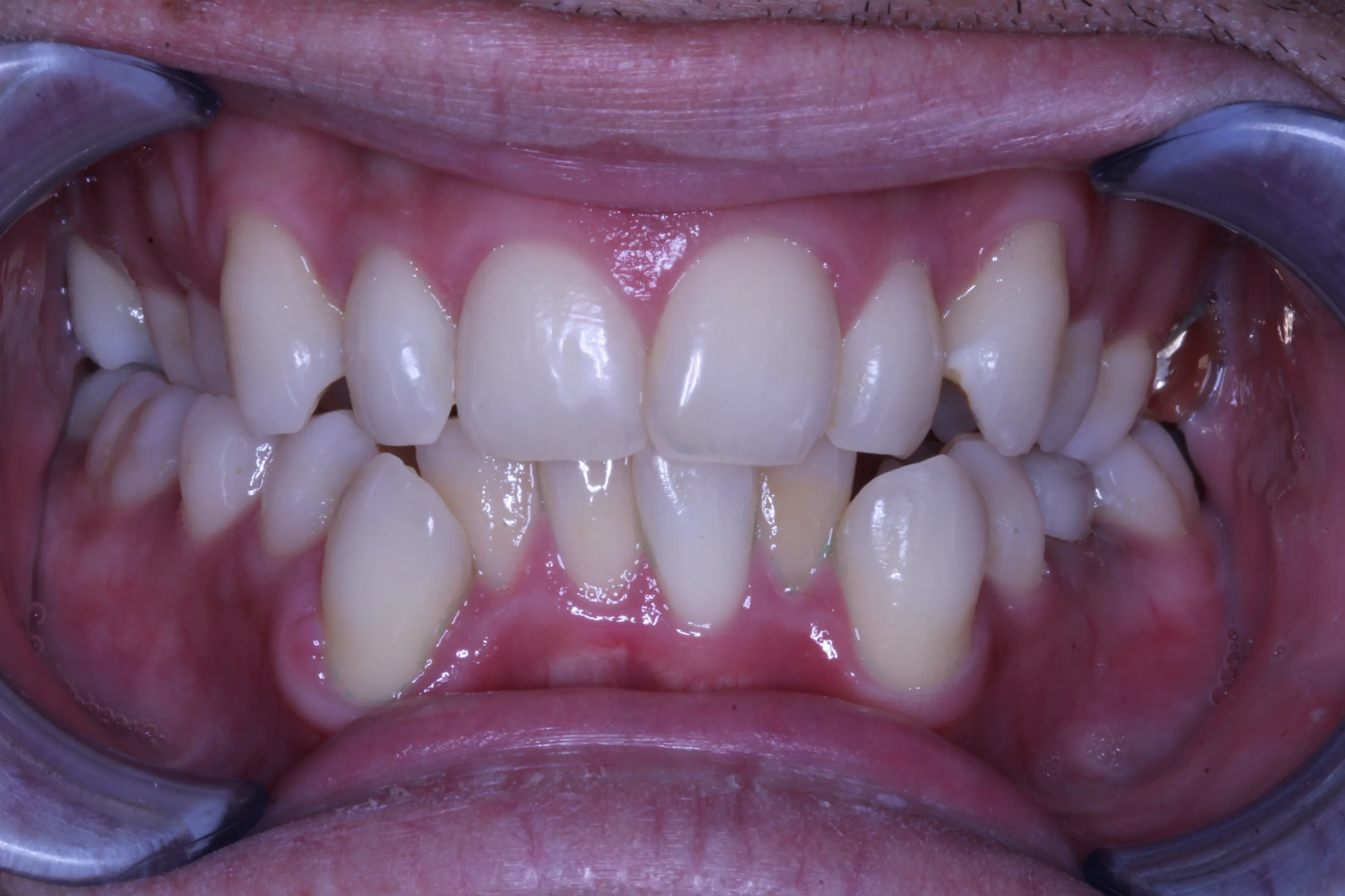 smile-gallery gallery